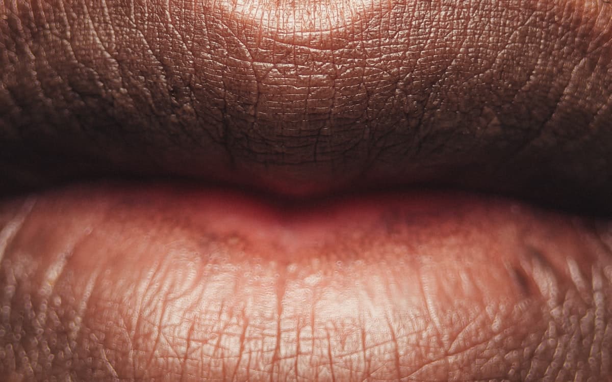 Labbra naturali dopo trattamento filler con acido ialuronico — risultato definitivo dopo una settimana