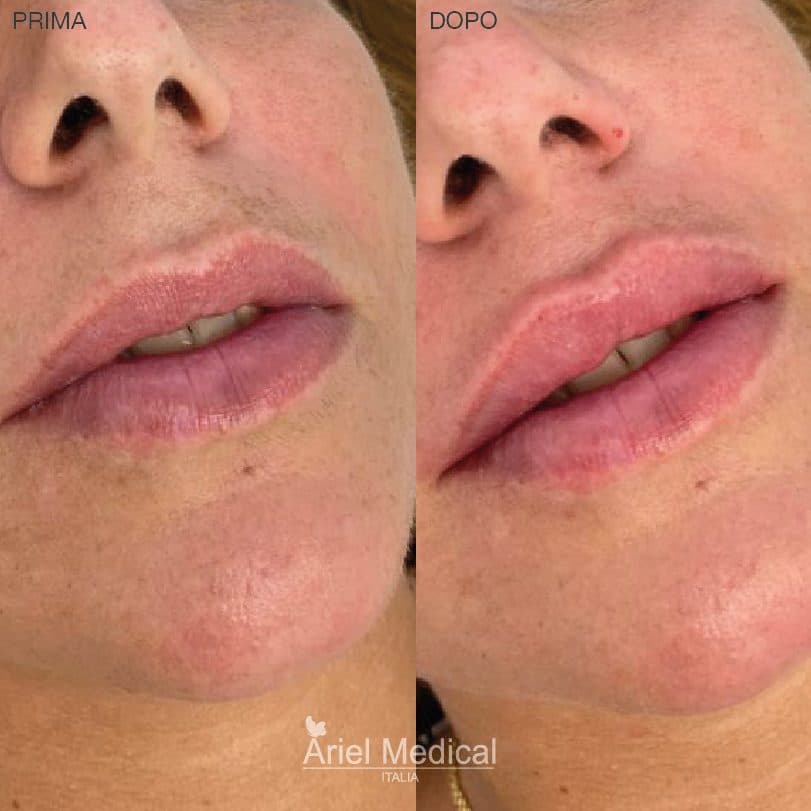 Luminosità rigenerata — Skin Glow, risultato Ariel Medical